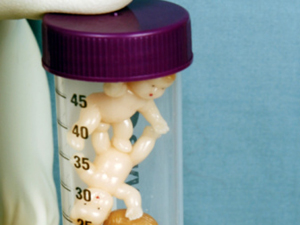 冷冻